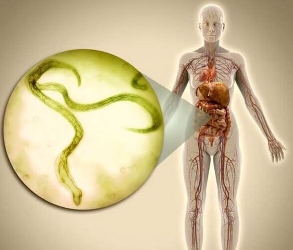 Parasites dans le corps humain