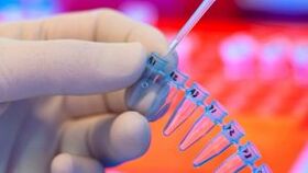 Comment passer des tests pour les parasites