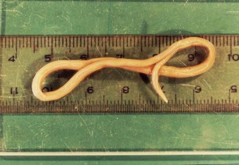 parasite des ascaris du corps humain
