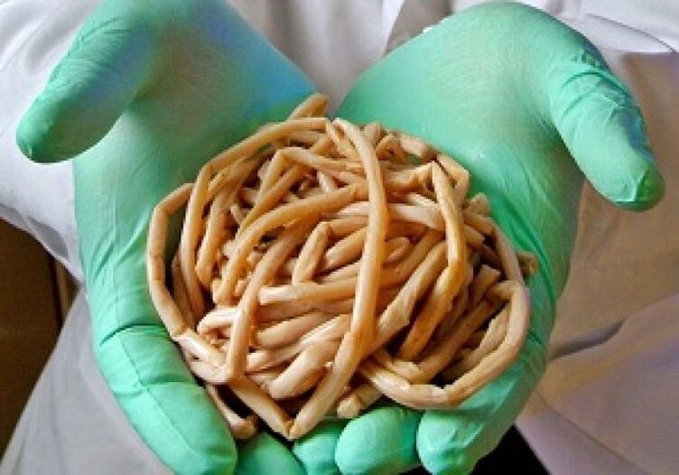 Vers parasites du corps humain