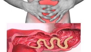 symptômes de la présence de parasites dans l'intestin humain
