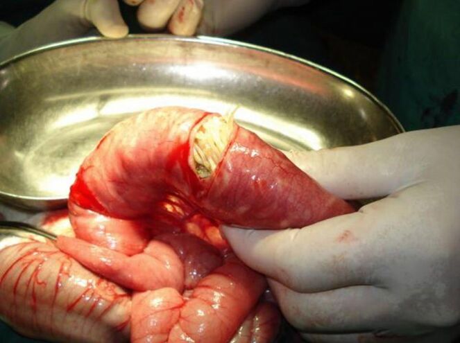 ces parasites sont dangereux pour les humains